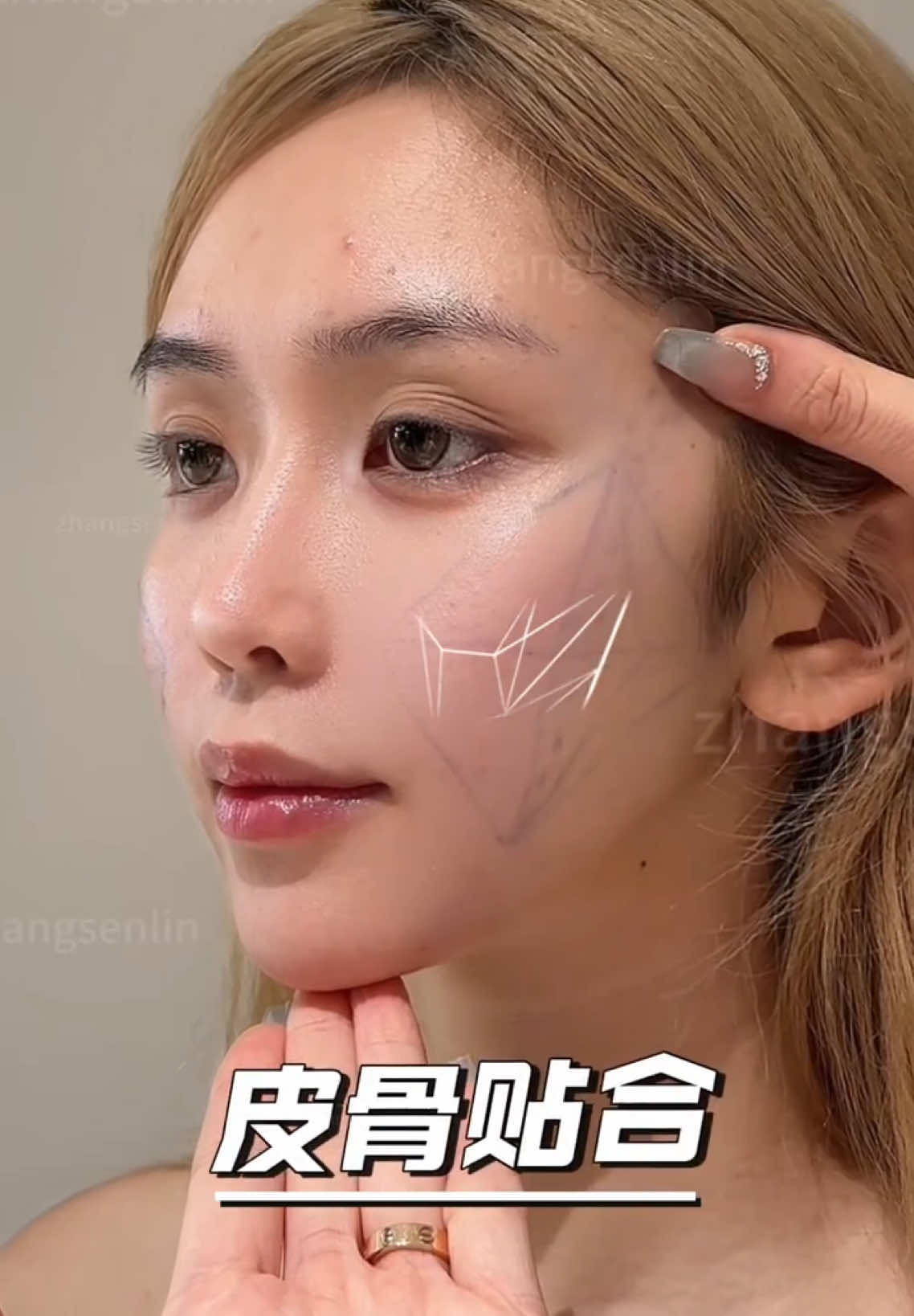 皮肤紧致，贴合，小v脸#fyp #Facelift #VLineFace #FaceLiftSurgery #面部提升 