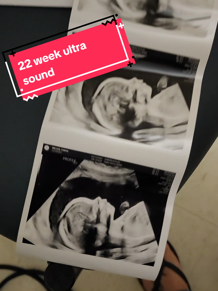 22 weeks everything's looking great