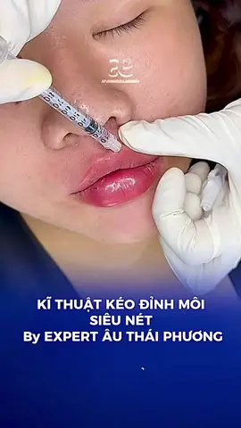 Kĩ thuật đẩy khoé uốn cong k im tặng b nào chưa biết . Kĩ thuật giúo các b tạo hình đỉnh môi rõ nét #authaiphuong #filler_botox_chuyên_nghiệp #đào_tạo_học_viên_chuyên_nghiệp #tiêmmôi #xuhuongtiktok 