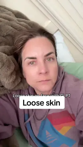 Help me out yo! The loose skin on my face is suuuuuper annoying.   #glp1forweightloss #glp1tips #glp1community #glp1sideeffects #glp1maintenance 