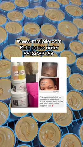 #haitiennetiktok🇭🇹🇭🇹🇭🇹🇭🇹😍😍😍😍 #mrsjolie #suportsmallbusiness #SmallBusiness #skincare 
