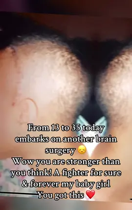 @HerStudd #dbs #brainsurgery #part2sept9 