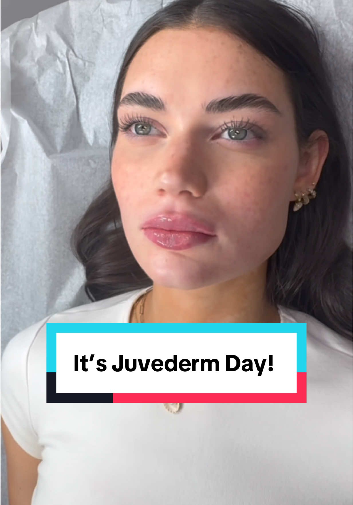 ✨ Buy one $75 gift card, get one FREE! ✨ Allē members who purchase a $75 Juvederm Collection of Fillers gift card today will receive a second one FREE to use with our expert injectors, Michelle or Shay. 💉🎁 Even better—you can stack this offer with our Summer Savings Special: 10% OFF your first injectables treatment. Claim your BOGO gift cards now by visiting alle.com/juvedermday #lipfiller #lipfillers #juvedermday #injectables #lipenhancement  