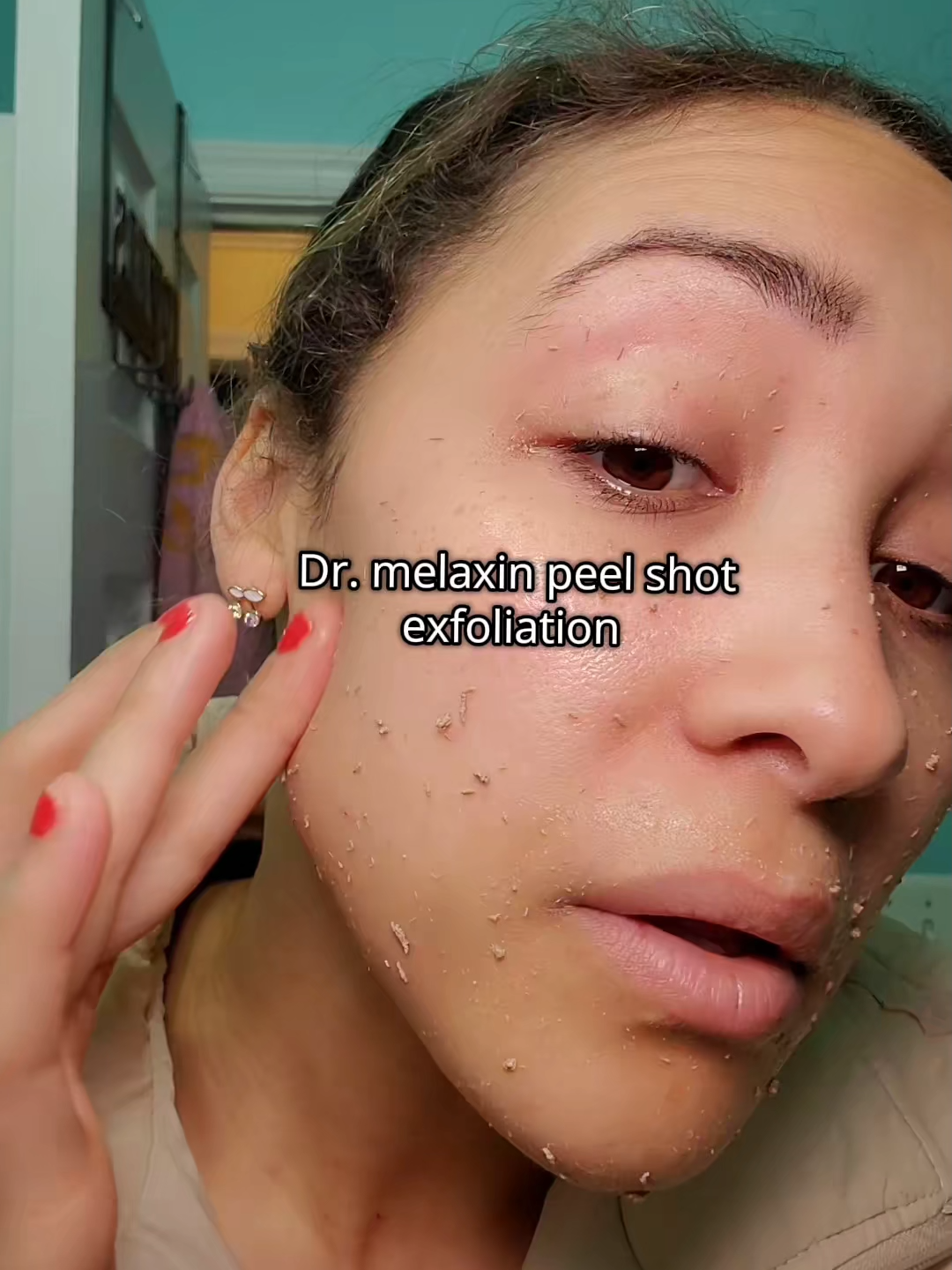 Skin back in the twenties#riceexfoliator #skincare #Drmelaxin #skinexfoliating#tenlifyhealth #fyp