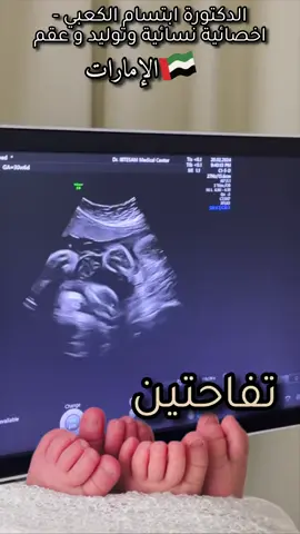 الحمل بتوأم 