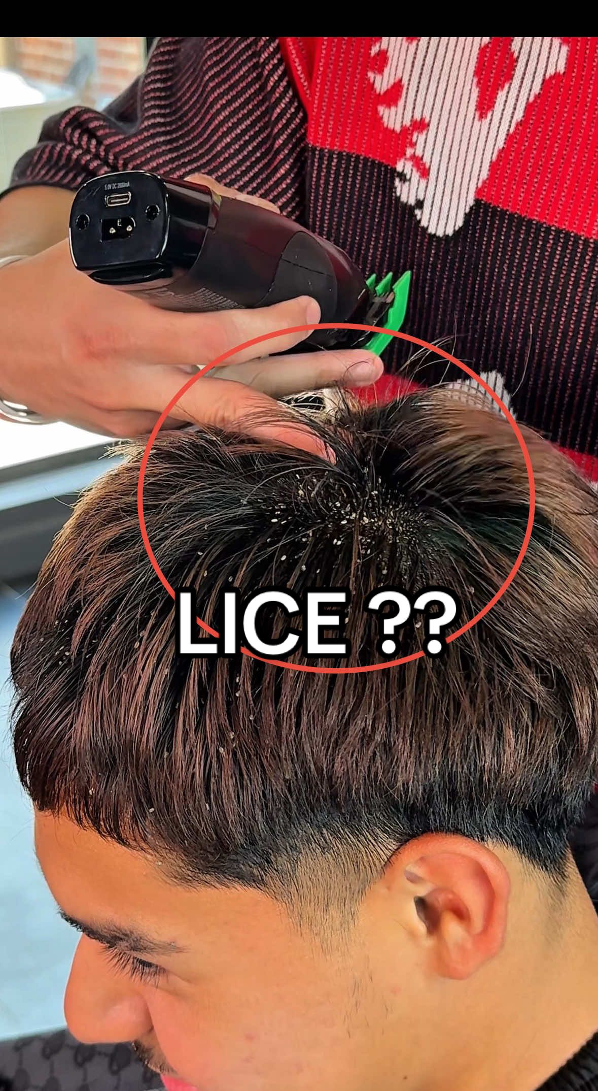 I removed lice from his hair 🤯🤯 was it worth $100  - #Barbertok #barber #oddlysatisfying #katybarber #besthoustonbarber        
