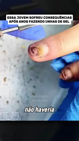 Essa jovem sofreu graves consequências #curiosidades #vocesabia #documentario 