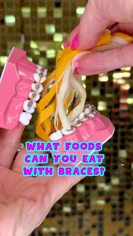 When does everyone go back to school?! 🦷 #braces #food #asmr #foryou 