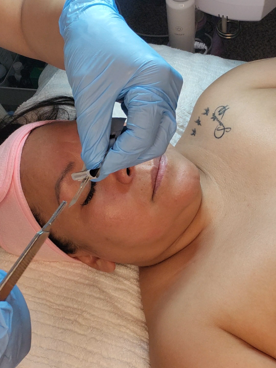 #facial #dermaplaning #enzimas #esteticista #denver 
