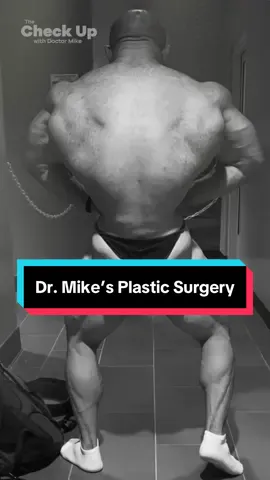 Why @Mike Israetel got plastic surgery