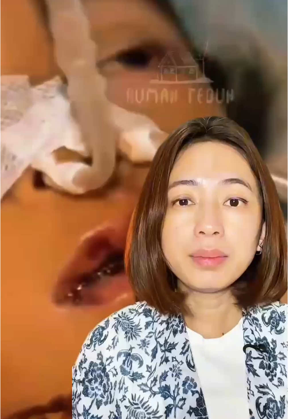 Cacingan itu bukan cuma soal perut buncit. Kasus Raya di Sukabumi jadi bukti kalau diabaikan, cacing bisa sampai ke paru-paru, bahkan otak. Anak usia 1–12 tahun perlu minum obat cacing tiap 6 bulan sekali, sesuai rekomendasi Kemenkes. Hal kecil ini bisa nyelametin nyawa. Jangan remehin cacingan. Jangan tunggu parah baru bertindak. Sumber video : Rumah Teduh #raya #cacingan #cacing #anaksehat #apotekerana 