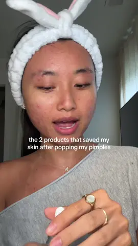 the texture has gotten SO much more flat after extractions and all the skincare😏 #pimples #acne #acneproneskin #acnejourney  @anua_global azeliac acid  @iUNIK beta glucan serum  @Vanicream™ Sensitive Skin Care moisturizer 