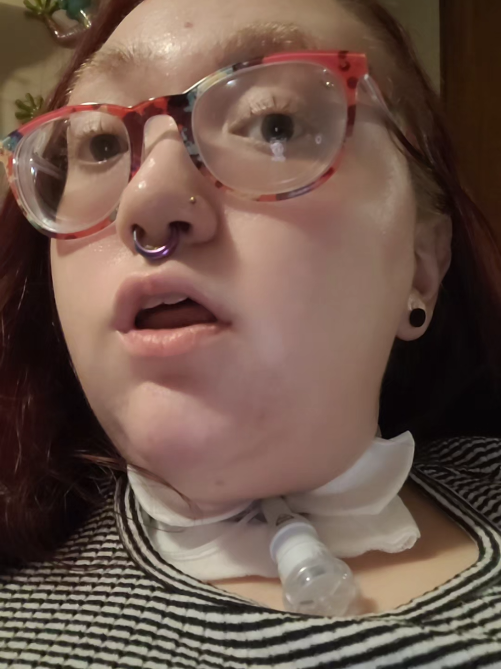 😭- #fyp #foryou #viral #funny #disabled 