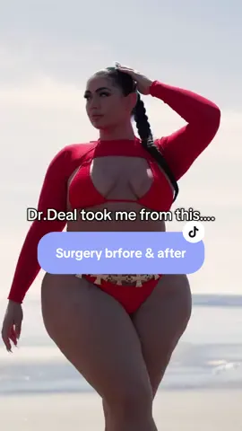 This was 2 surgeries. A breast augmentation and a body sculpting with lipo, fat transfer and skin tightening. @drhidef @SouthernSurgicalArts 