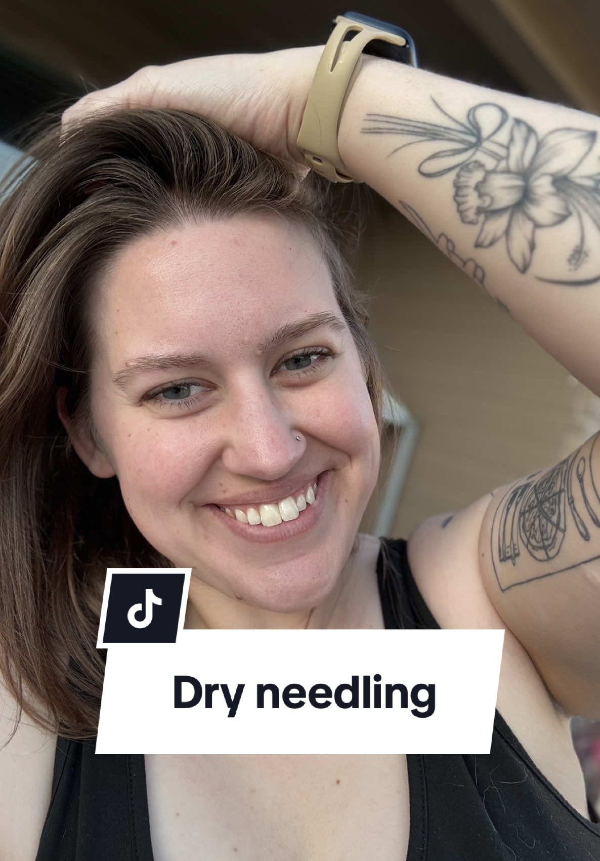 WARNING ‼️ Needles 💉 One of my fave forms of self care is physical therapy 👌🏼 my TMJ problems don’t stand a chance. #tmjtreatment #tmjrelief #dryneedletherapy #SelfCare 