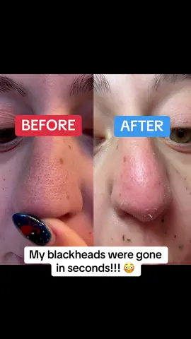 I’m so embarrassed!!! 😞😩😩 #tiktokshopcreatorpicks 