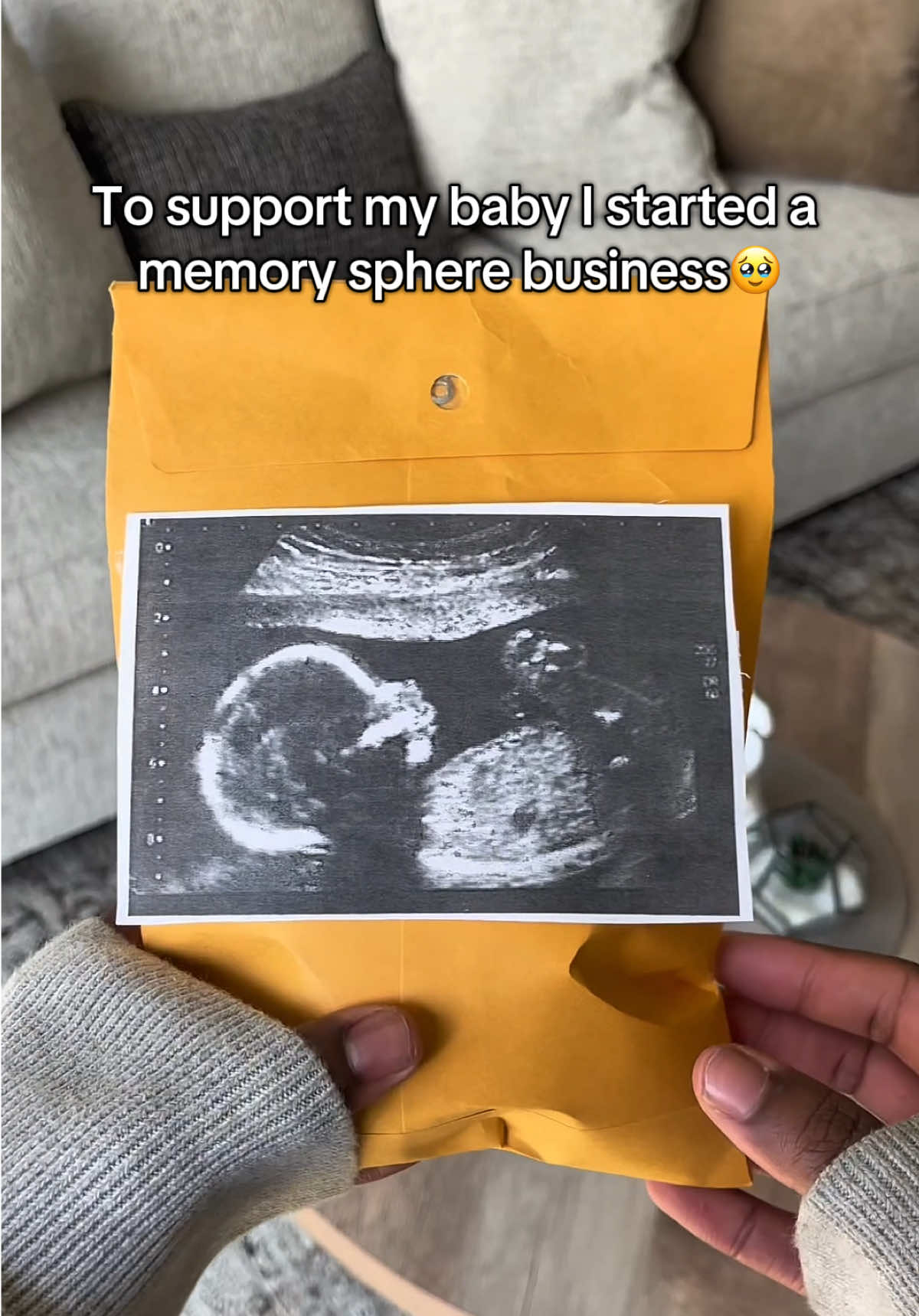 Please support, any bit helps 🥹❤️ #pregnancygift #pregnant #pregnancy #ultrasound #babygift 