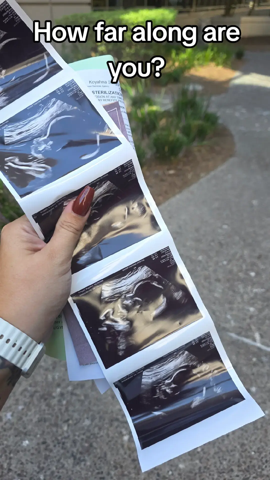 #momtok #fyp #xyzbca #pregnancyjourney #pregnant 
