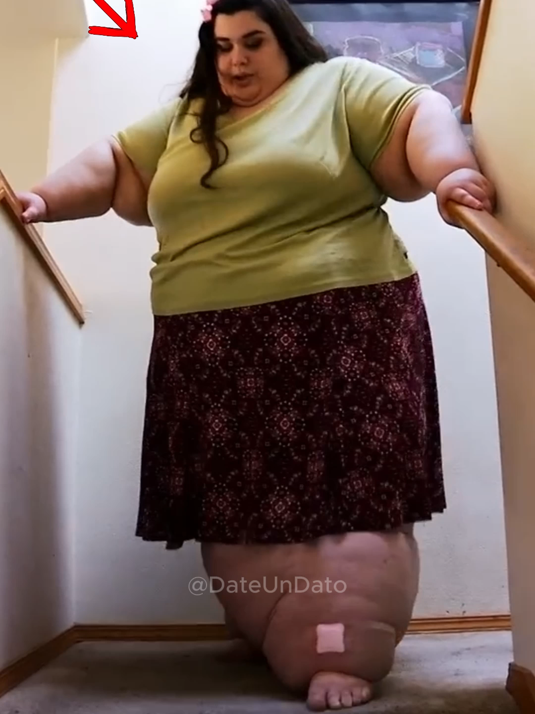 La increíble TRANSFORMACIÓN de unas mujer OBESA 😱#SabiasQue #cosasquenosabias #curiosidades #datos