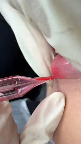 Khử thâm môi #lipstick #lips #phunmoi #khuthammoi #lamdep #fyp 