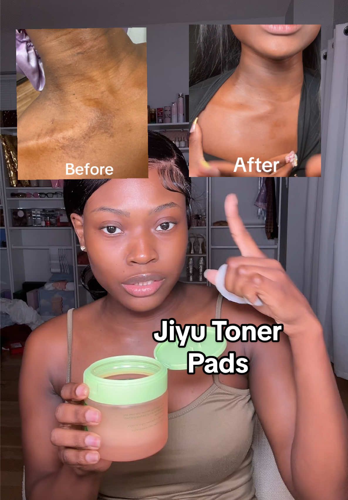 Jiyu Toner Pads💚💚 #Hyperpigmentation #clearskin #KoreanSkincare #tonerpads #TikTokShopCreatorPicks 