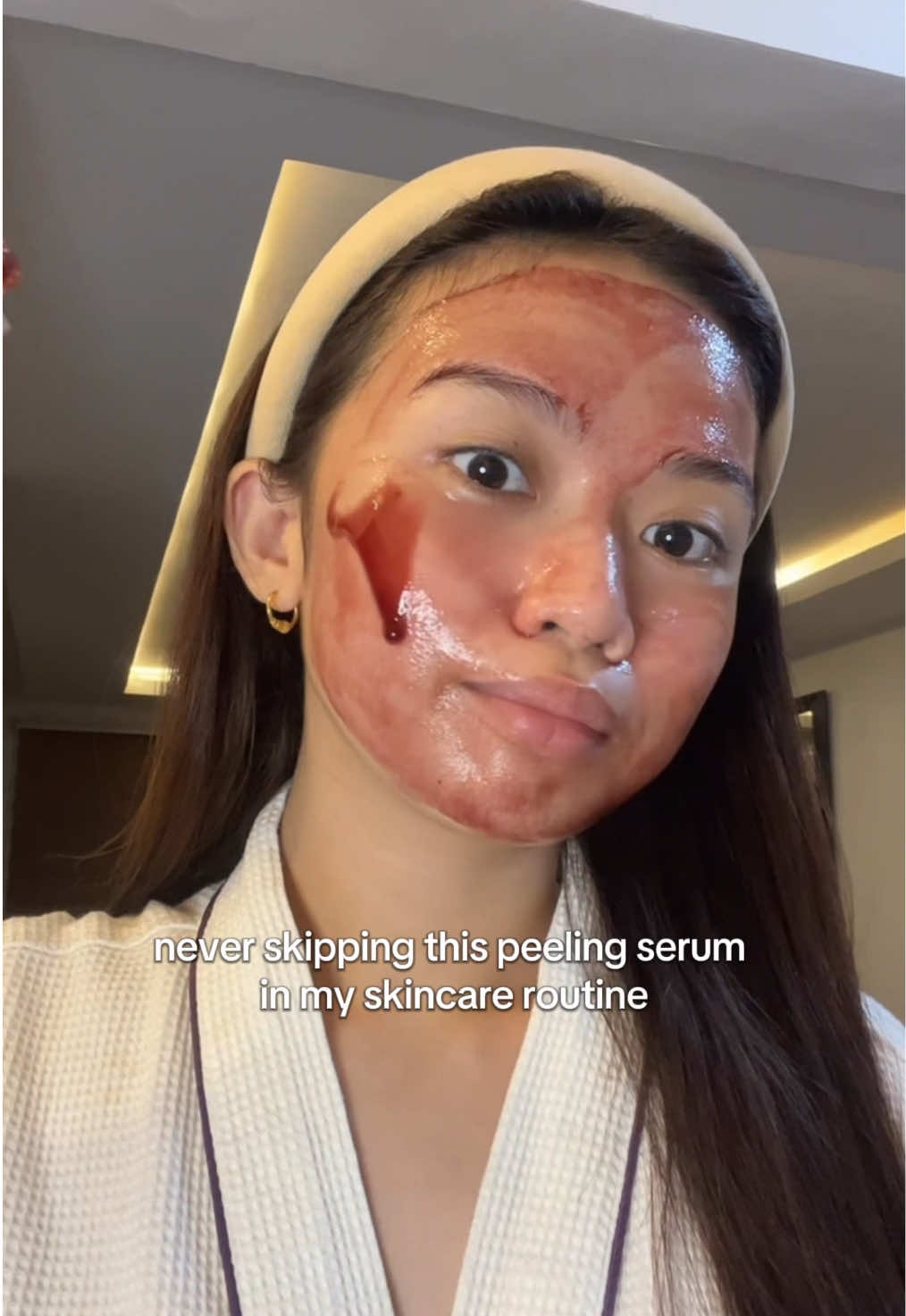 G2G’s Peeling Solution is my ultimate holy grail! ✨💆🏼‍♀️ #peelingsolution #peelingserum #exfoliator #g2gpeelingsolution #g2gph 