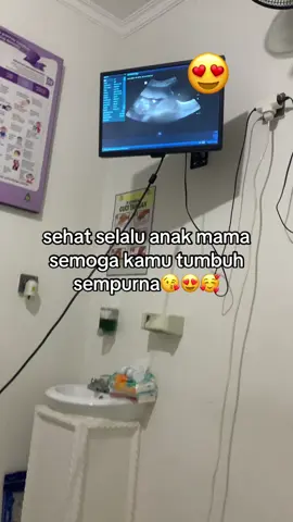 #fyp #trendingtiktok #xyzbcafypシ #masukberanda #promoseruweekend 
