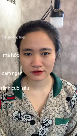 sau 30p trẻ ra 5 tuổi liệu có xứng đáng??#tiemtangmatgiua #tangmatgiua 