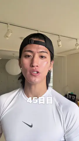 イソトレチノイン経過記録📝 #イソトレチノイン #イソトレ #ニキビ #ニキビ跡 #メイク               