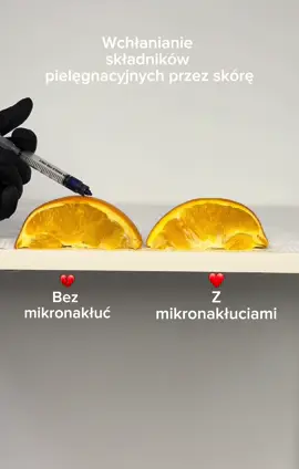Czy wiesz, że skuteczność Twoich kosmetyków może zależeć od stanu skóry? Przed zabiegiem mikrodermabrazji mikroigłowej składniki aktywne wnikają tylko w górne warstwy naskórka. Po zabiegu ich wchłanianie jest wielokrotnie wyższe, bo mikronakłucia tworzą drogi transportu w głąb skóry. Dzięki temu substancje odżywcze, nawilżające i przeciwstarzeniowe działają intensywniej i szybciej. To dlatego zabiegi łączone dają tak spektakularne efekty 🪄 #mikroneedling #skincare #viral 