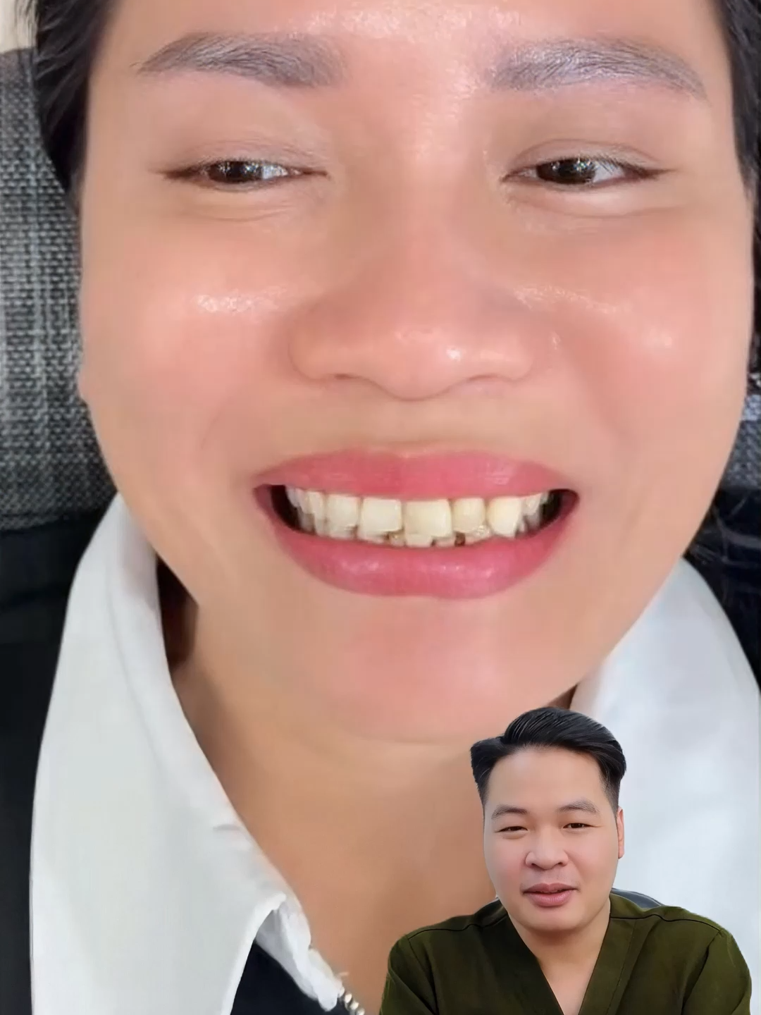 Chị khách trung niên tươi trẻ và tự tin hơn sau khi làm răng sứ #drThu #BsThu #Dansuthammy #Veneer
