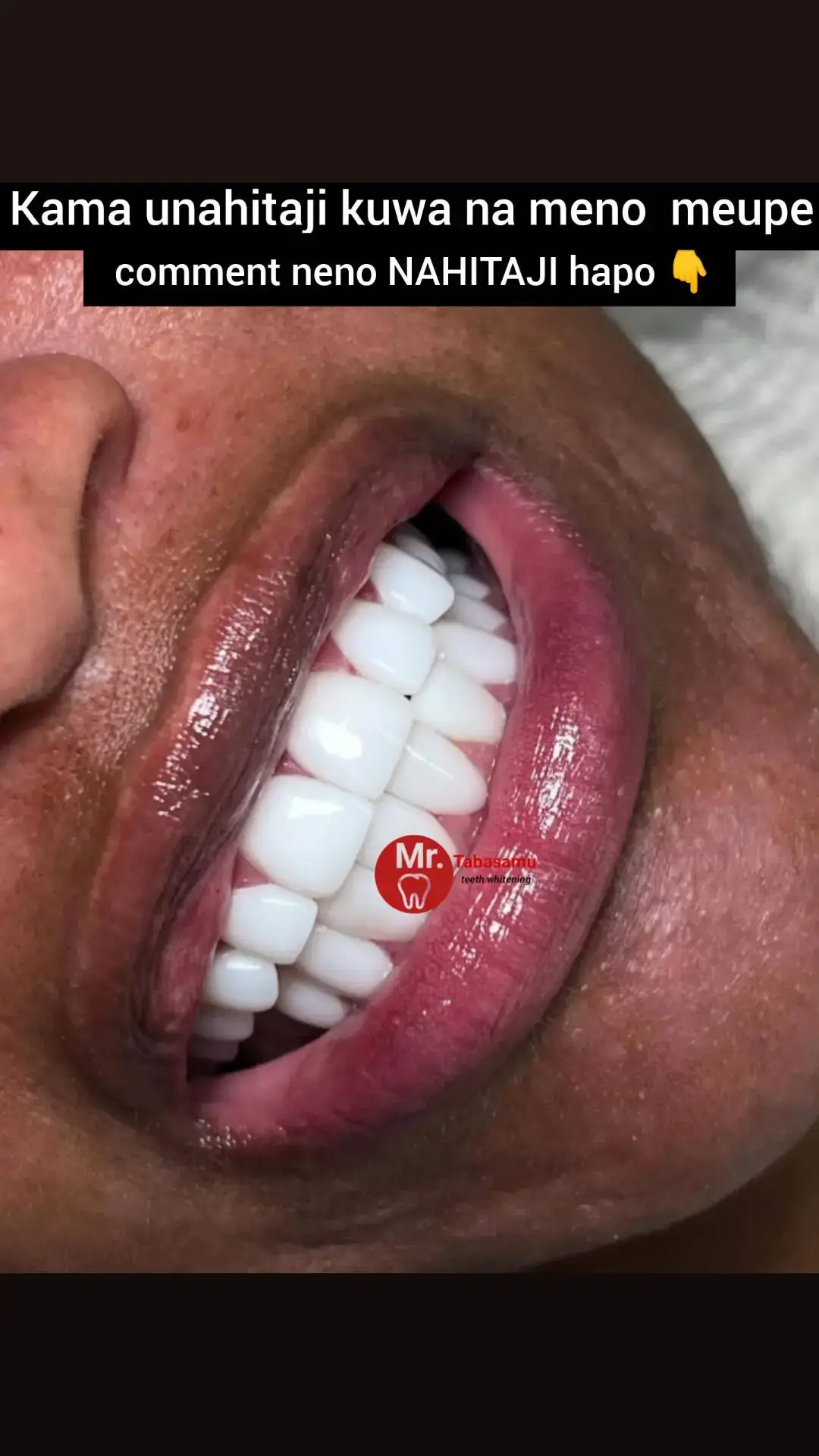 #newsmile# tabasamu lako ni kipaumbele kwetu karibu tabasamu Beauty Kwa huduma bora na za uhakika kwa afya ya kinywa chako !! #0652012402 #0654416710  #tabasamubeuty #kenyantiktok🇰🇪 #tanzaniantiktok🇹🇿 