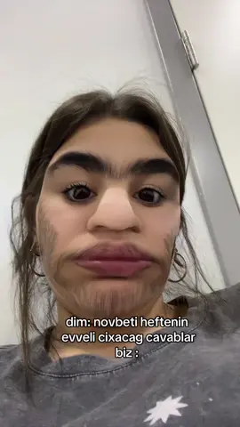 SENIN DERDIN NE