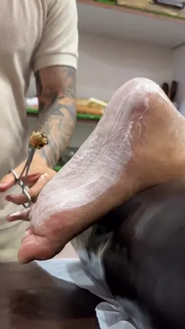 wowww asmr hot cupping😍❤️ . . . . . . #بادکش #بادکش_درمانی #بادکش_گرم #cupping #cuppingtherapy 