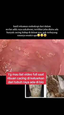 video cacing dikeluarkan dari dalam tubuh raya #fakesituation⚠️ #rayasukabumi #rayacacingdidalamtubuh #videocacingdikeluarkandaridalamtubuhraya #fyp 