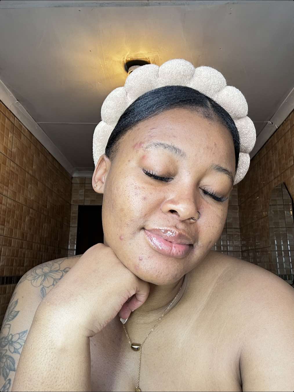 Still venting about my break out  Lona😭💔  On my way to get barrier cream. Someone said that’s the first thing I should get because my barrier is possibly damaged🥲😪  I’ll drop of a video of the full story of how my skin rejected products tsa Drillion that I thought would work. Hacked in an understatement.  #acneproneskin #fyp #confidence #foryo #damagedskinbarrier 
