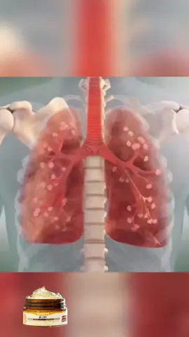 El producto del video está en mi escaparate de TikTok, disponible solo para la región de México.