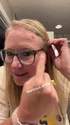 The clock tick tocking is sending me 🤣#skincancer #skincancerawareness #pray 