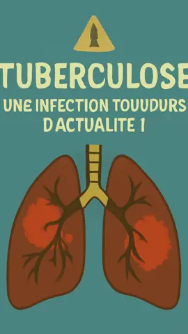 🔥 La tuberculose est encore l’une des maladies infectieuses les plus mortelles dans le monde. Sais-tu comment elle se transmet, quels sont ses signes et comment on la traite ? Découvre en 1 min l’essentiel à savoir pour mieux comprendre et prévenir cette maladie. 👉 Symptômes, transmission, diagnostic et traitement expliqués simplement. ⚠️ Une vidéo utile pour étudiants en médecine, soignants et toute personne soucieuse de sa santé. #Tuberculose #Santé #Médecine #Infection #Prévention  