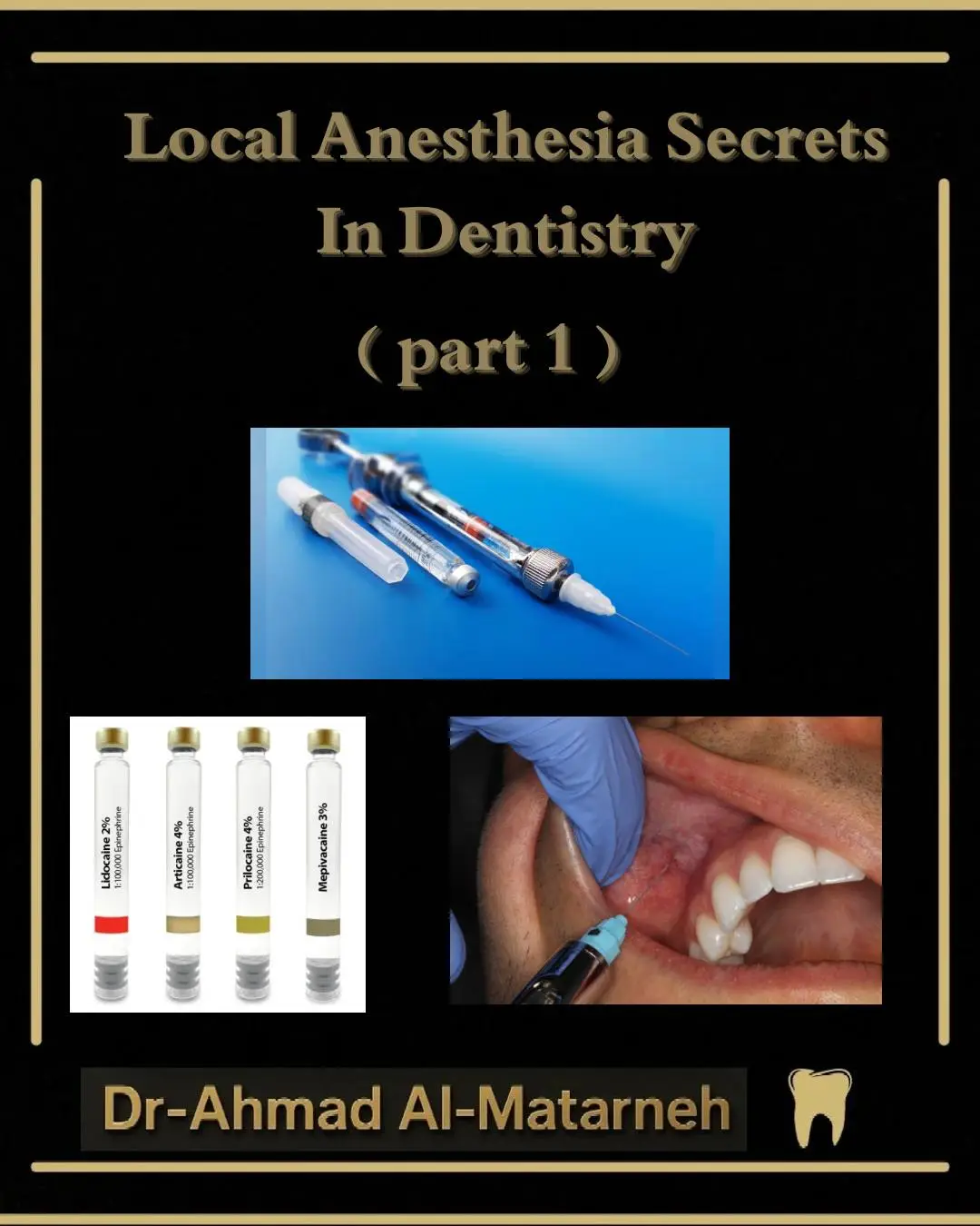 #endodontics  #dentistryworld  #dentalstudent  #dentistlife  #طب_الاسنان