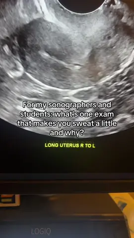 #ultrasound #ultrasoundsrudent #ultrasoundtech #sonographer #sonographystudent 