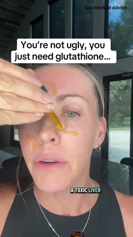 Your liver and gut issues show up on your skin…#glutathione #terrahealth #over40club #cysticacne #holistichealth 