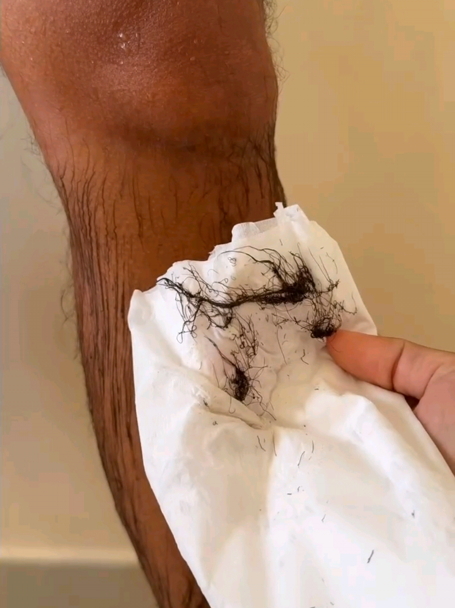 الخميره والليمون‼️كنز في بيتك هيخلصك من شعر جسمك🙈 وودعي طرق ازاله الشعر 🔥 #reels #skincare #ازاله_شعر#skincareroutine #وصفات_طبيعيه 