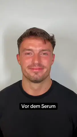Falten? Kenn ich nicht mehr 😌✨ Mein kleiner Anti-Aging Hack für zu Hause🧴💎 • • • #viral #fyp #skincare #GlowUp #antiaging 