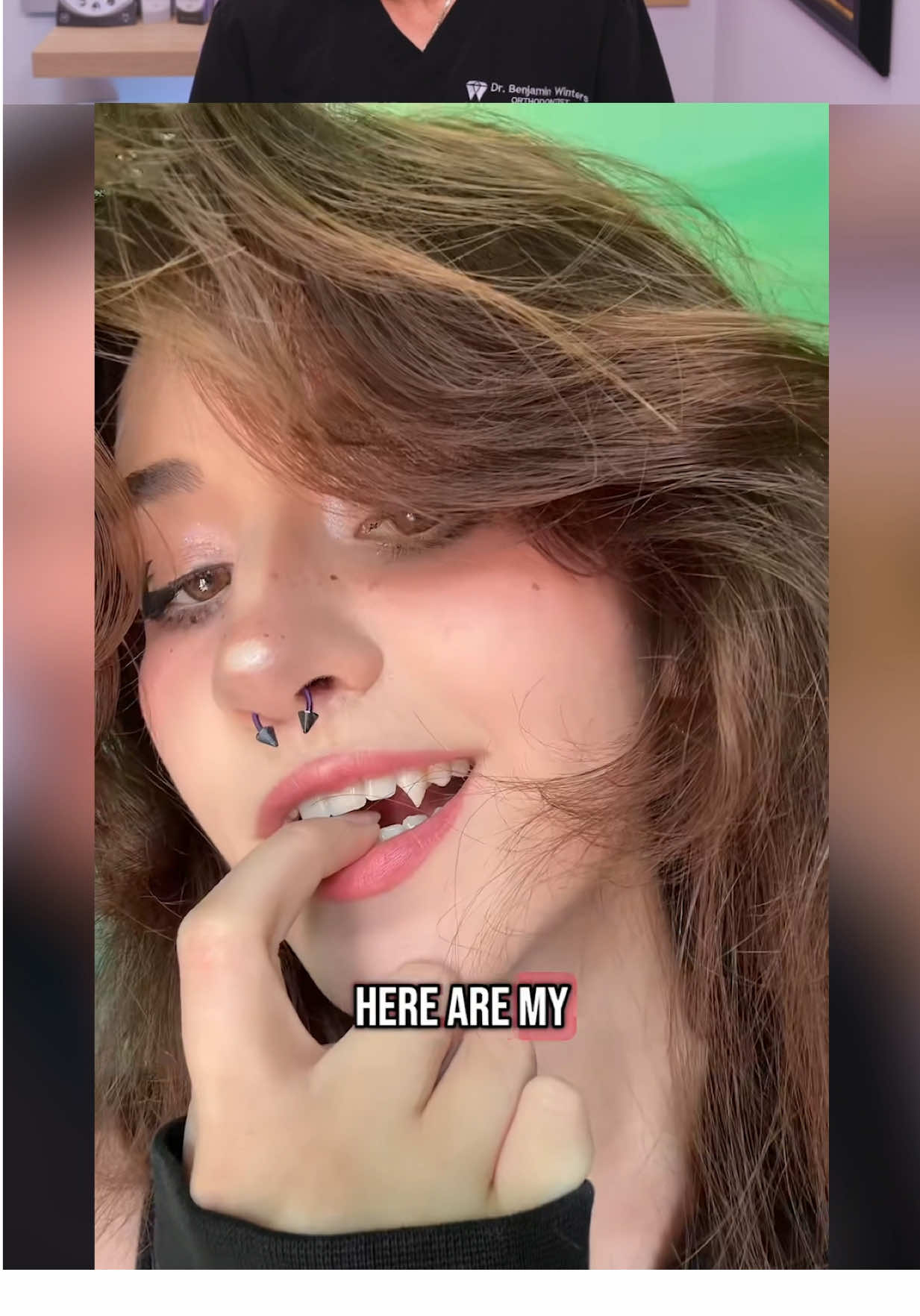 She Got Permanent VAMPIRE Teeth?! 😮🦷 #teeth #braces #dentist 
