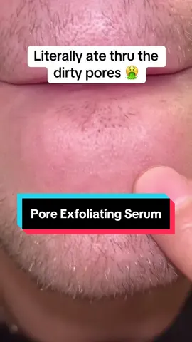 My skin feels so smooth now #facial #skincare #skincareproducts #skin #healthyskin 