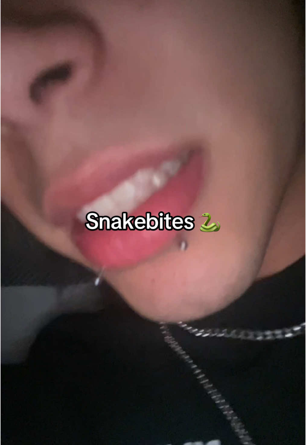 If you got snakebites tell me you can relate 😭😭#snakebites #piercing #foryou #piercingtok 