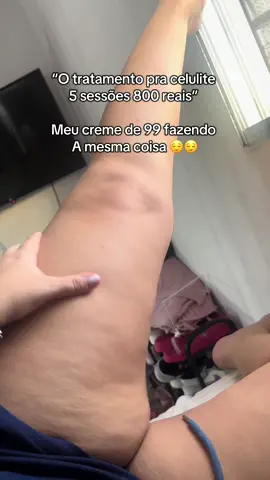 Pra mim que estava muito obesa e com lipedema foi o que resolveu #emagrecimento #flacidez #estrias #foliculite #cremepopozuda 