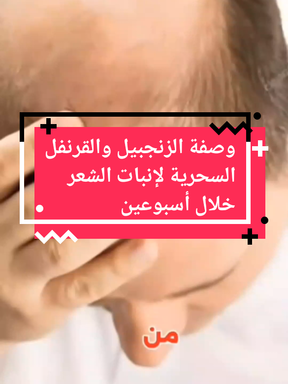وصفة الزنجبيل والقرنفل السحرية لإنبات الشعر خلال أسبوعين #انبات_الشعر #زيت_طبيعي #وصفات_شعر #تكثيف_الشعر #علاج_الصلع