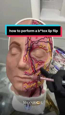 #botox #botoxtraining #botoxtutorial #lipflip #antiwrinkle 
